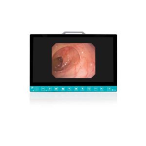 China TUYOU 13.3-Inch FHD Flexible Endoscope Camera System Multi-Color OEM Custom All-in-One Portable Uro-Gyn TikTok Hit on sale