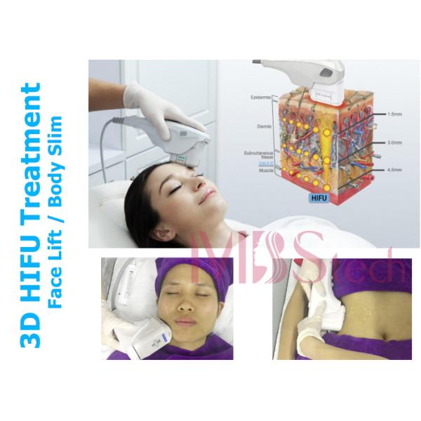 Ultrasonic Remove Wrinkle Skin Tighten 3D HIFU RF Machine