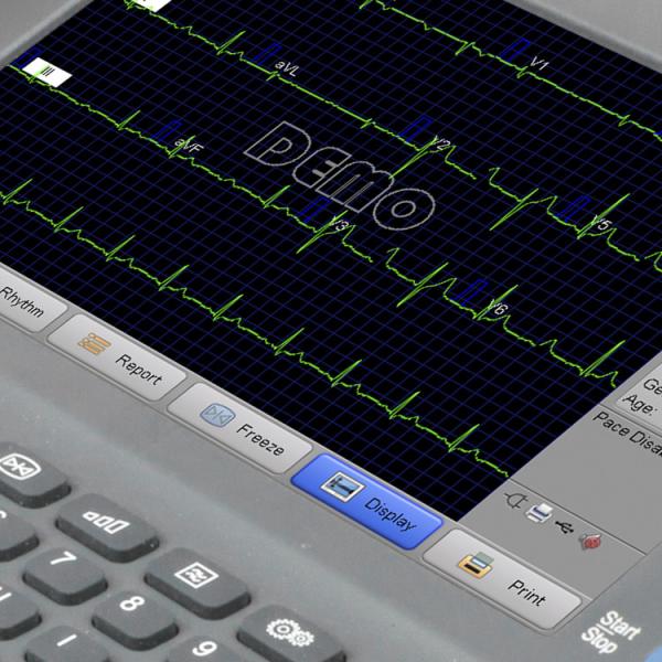 LCD Display Portable ECG Machine 3 Channel Ecg Holter Monitor