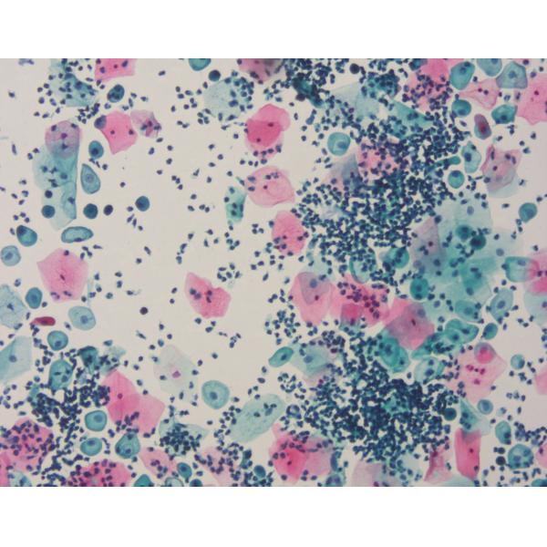 PAPANICOLAOU STAIN EA50 Baso Clear Colourful Stains for Cell Coloring