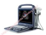 SonoScape Convex Array Transducer Probe C344 For S2 Portable Ultrasound System