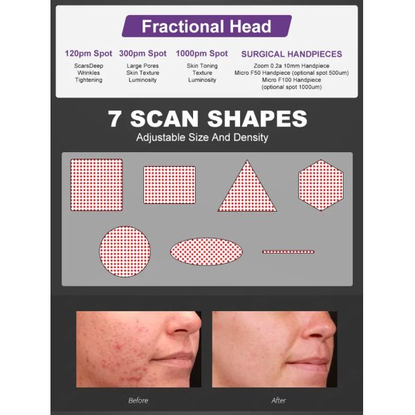 1060nm Fractional CO2 laser Machine Portable CO2 Laser Skin Resurfacing Machine 4000w