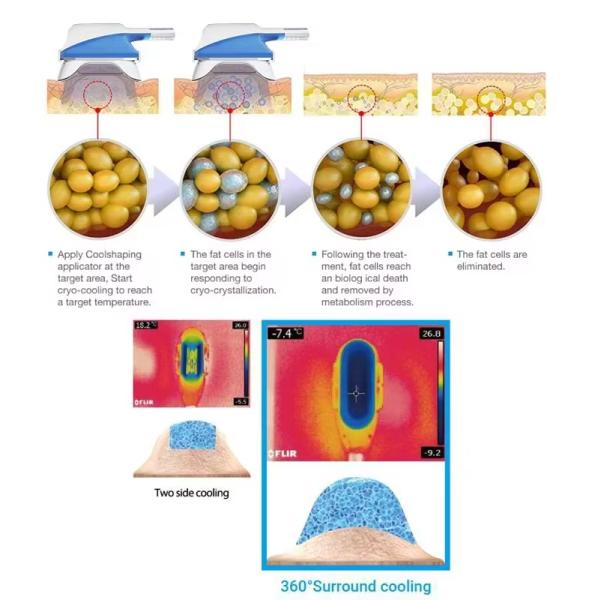 Multifunctional 360 Cryo 40K Cavitation Body Sculpting Machine With Chin And Rf Cavitation Laser