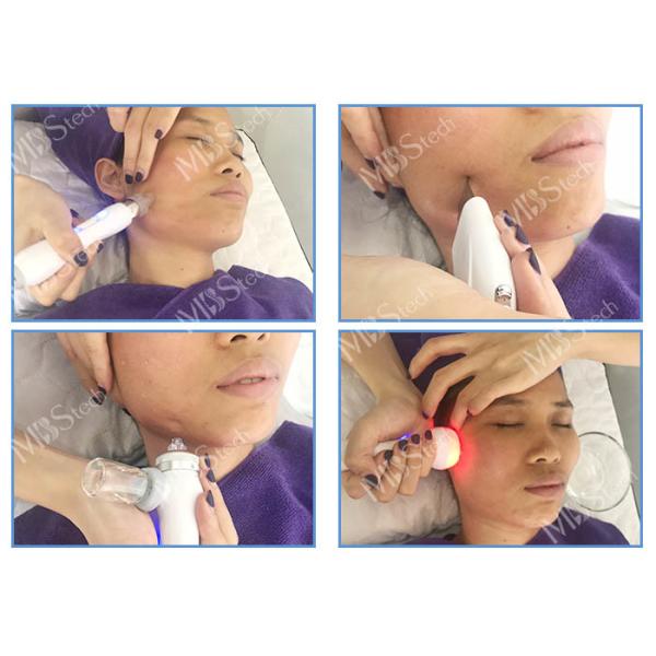 Deep Cleansing Hydro Water Microdermabrasion Facial Machine