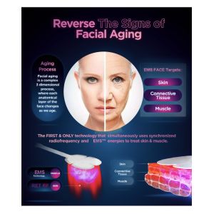 Advanced Desktop EMS RF Face Sculpting Machine for Skin Tightening and Wrinkle