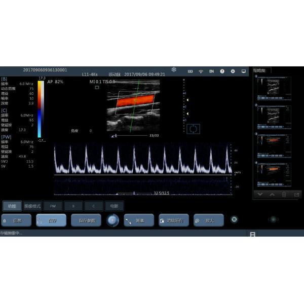 Cardiac Handheld Ultrasound Machine Wireless Ultrasound Probe Human Or Vet Usage Available