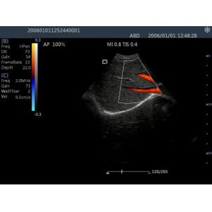Buy cheap Portable Ultrasound Scanner Color Doppler Machine With 15 Inch LCD Monitor from wholesalers