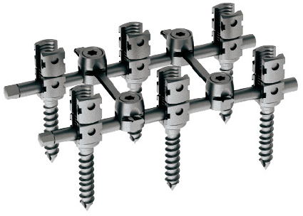 Flexible Spine Fixation System , Break Off Spinal Pedicle Poly Axial Screw