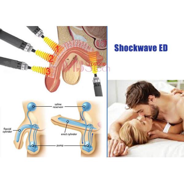 200mj Intelligent Extracorporeal Focused ED Shockwave Machine