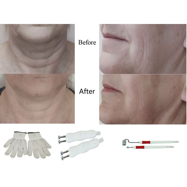 3 In 1 Galvanic BIO Microcurrent Machine 35W Face Wrinkle Remover Machine