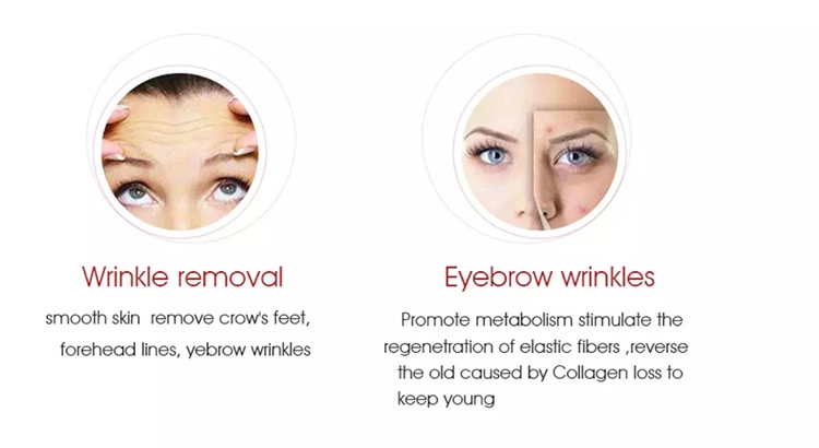 Home Use Vmax Smas Lifting Machine Hifu Facial Machine Wrinkles Removal And Skin Tighten