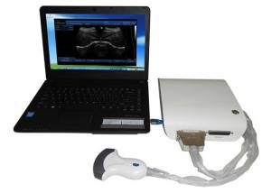 China High Resolution Portable Ultrasound Scanner 3D B / W Ultrasound Box With USB Port on sale