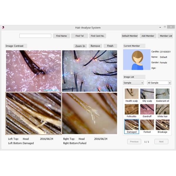 8MP High Resolution Digital Multifunction UV Skin Analyzer compatible with windows 10