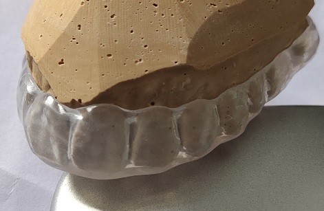 Occlusal Splint Upper Arch Comfortable Mouth Guard For Bruxism