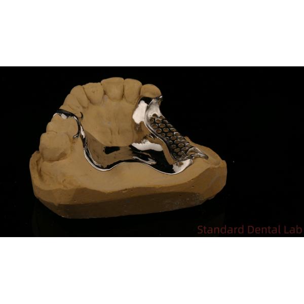 High Strength 3D Printed Cast Framework COCR Partial Dentures Chrome Cobalt Cast Metal Framework