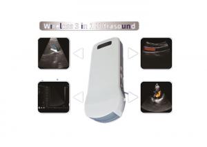 China Color Doppler Sonography Color Doppler Ultrasound Scanner With Built-in WiFi Signal Wireless Charging 2.5MHz~10MHz Freq wholesale