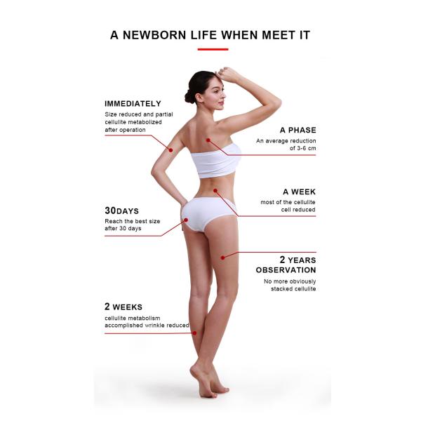 4MHZ HIFU Beauty Machine , Lose Weight Slimming Machine AC 110V-220V