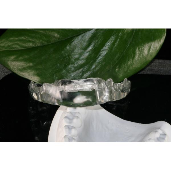 Custom Night Guard For Teeth Clenching