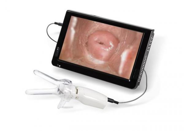High Definition Women Self-Examination Endoscope AV ( video ) Signal Digital Electronic Colposcope 3