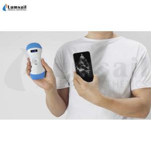 China Linear Convex Phased Array 3 In 1 Handheld Pocket Ultrasound Scanner With APP on sale