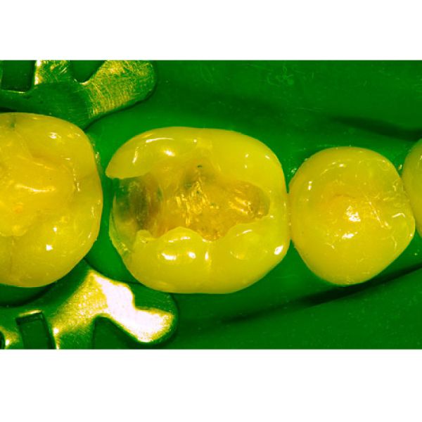 Stable 50-60Hz Dental Surgical Microscope In Endodontics Multiscene