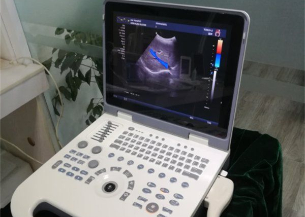 Panoramic Focusing Color Doppler Machine With 4D Function Optional