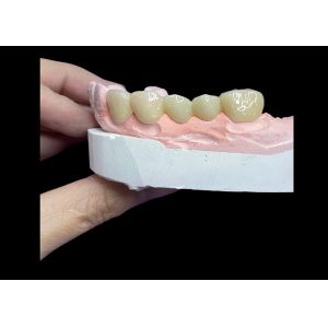 Buy cheap All Ceramic Crowns and Bridges Designed for Superior Aesthetics Durability and from wholesalers