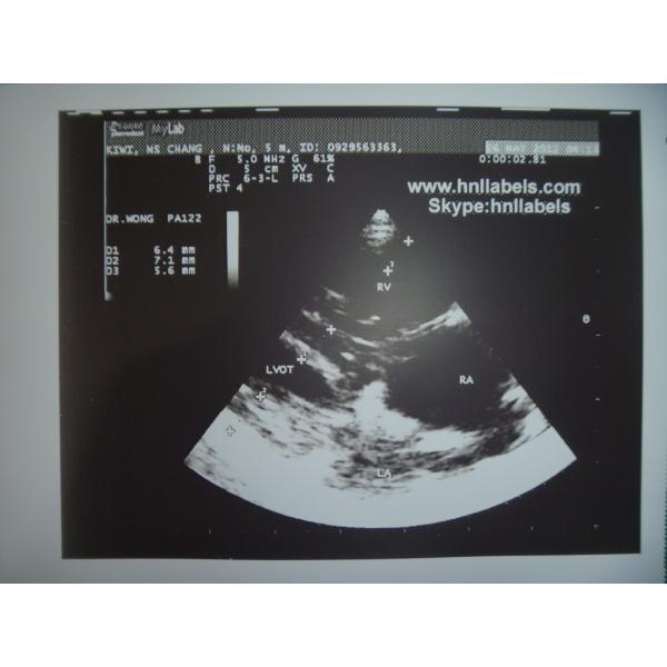 Ultrasonic Paper Compatible UPP-110s Medical Printing Media(Upp-110s Paper)