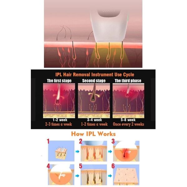 CE ROHS TM Technology 320g IPL Laser Removal Device